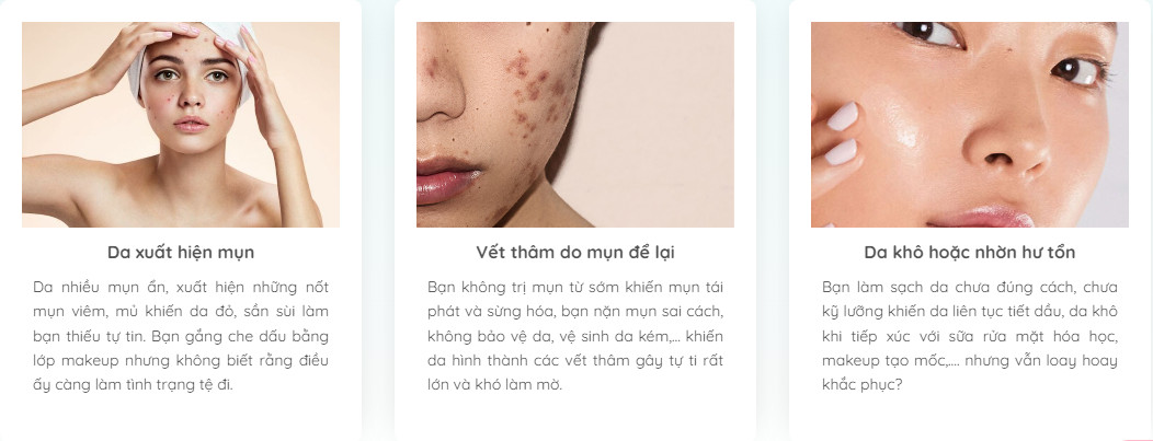 vien uong tri mun acnesplus 2